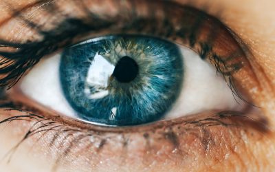 Problemas de visão: Estrabismo